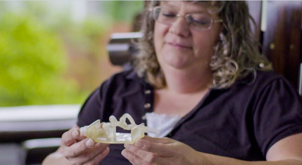 3D Printed Vascular Model Helps Surgeons Cure Brain Aneurysm