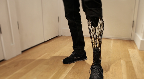 The creative Exo prosthetic limb
